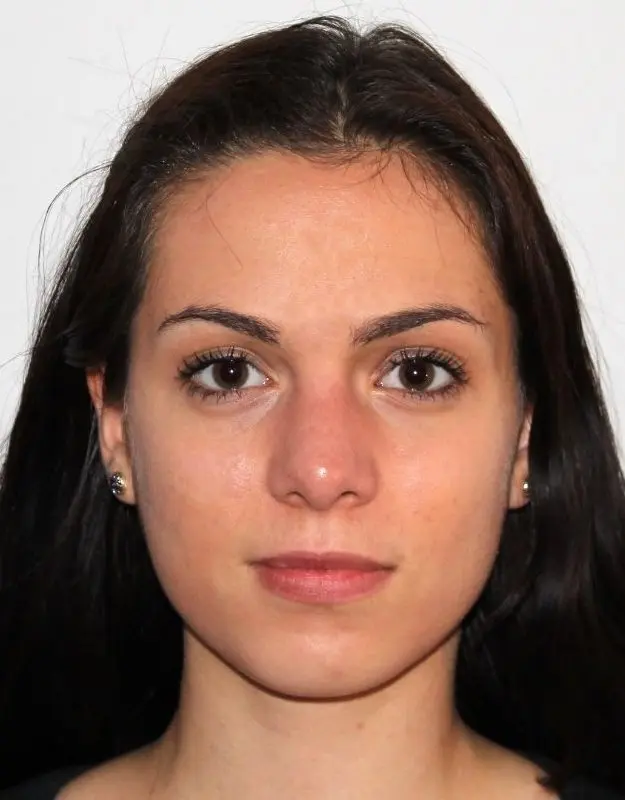 Anna-Sophia Lippoldt, B.A. Sporttherapie und Prävention